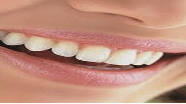 Het aanstekelijke van lachen…