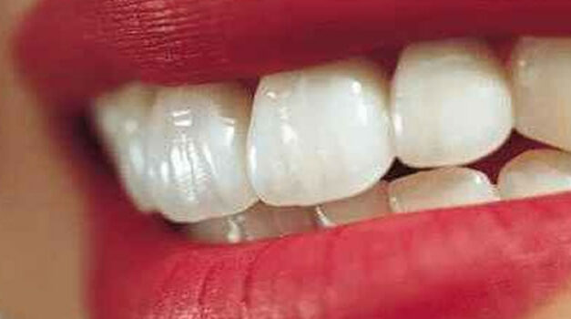 Gezond tandvlees en gebit