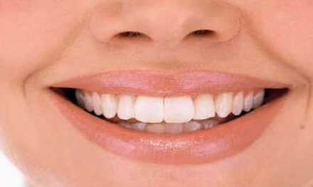 The BEST Way to Whiten Your Teeth (without ruining them)