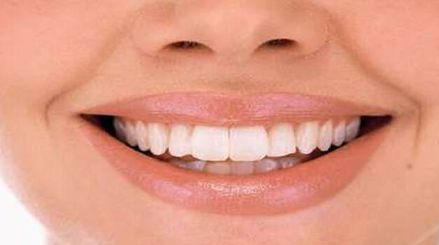 The BEST Way to Whiten Your Teeth (without ruining them)