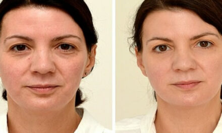 Water drinken verjongt (zie het verschil na vier weken)