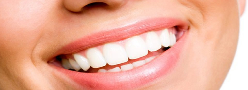 Hou krijg je witte tanden?